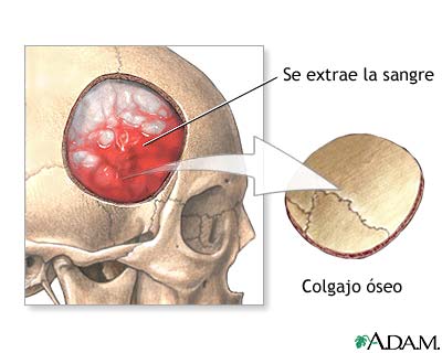 Procedimiento