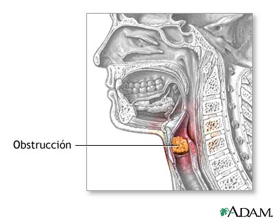 Indicaciones