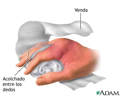 Indicaciones (primera parte)