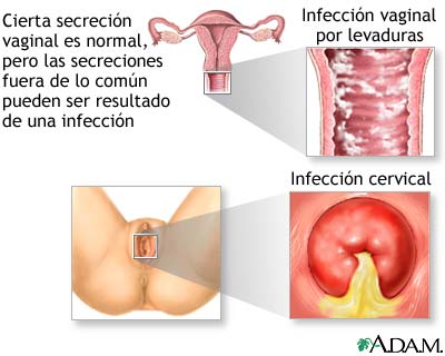 Secreción vaginal
