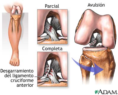 Grados de LCA