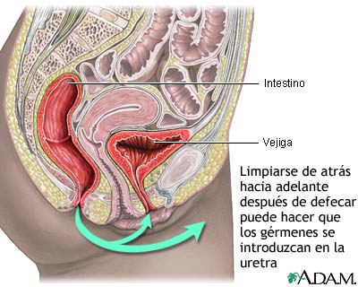 Prevención de la cistitis
