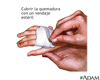 Procedimiento, parte 2