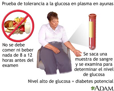 Prueba de tolerancia a la glucosa en ayunas