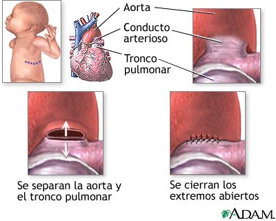 Procedimiento
