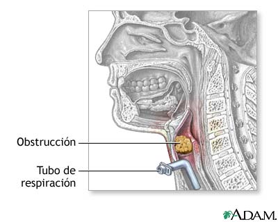 Procedimiento