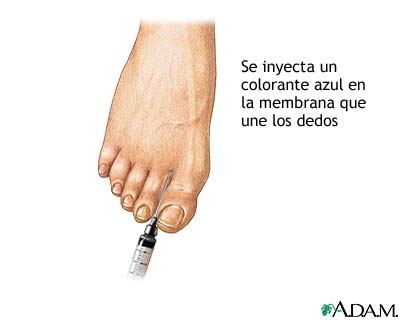 Linfangiograma