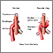 Anillo vascular