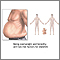 Factores de riesgo de diabetes