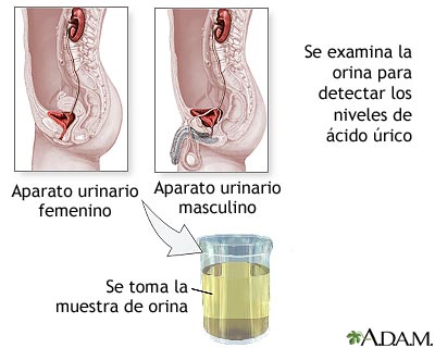 Prueba de ácido úrico