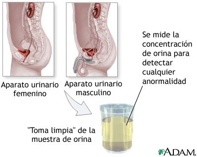 Prueba de concentración de orina