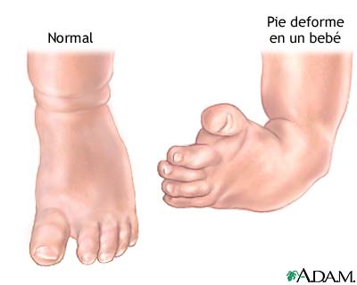 Anatomía normal