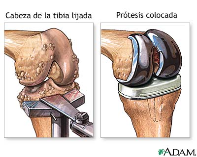 Procedimiento