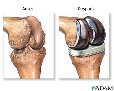 Cuidados postoperatorios
