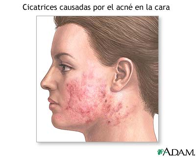 Indicaciones