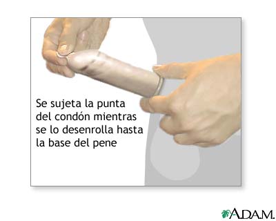 Cuidados posteriores