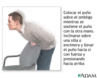 Automaniobra de Heimlich