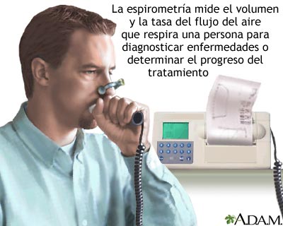 Espirometría