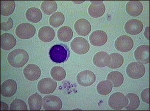 Gl&oacute;bulos rojos normales