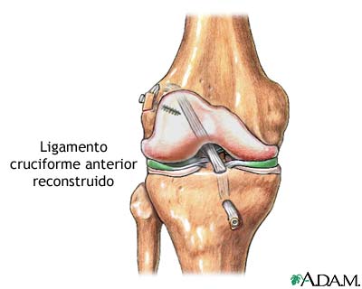 Cuidados postoperatorios