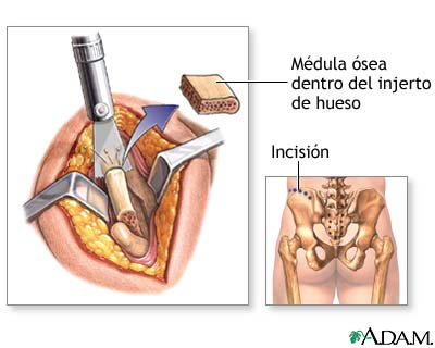 Procedimiento (primera parte)