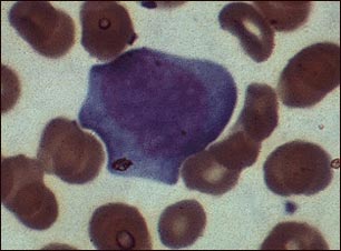 Mononucleosis, microfotografía de células