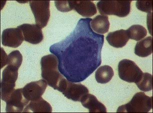 Mononucleosis, microfotografía de células