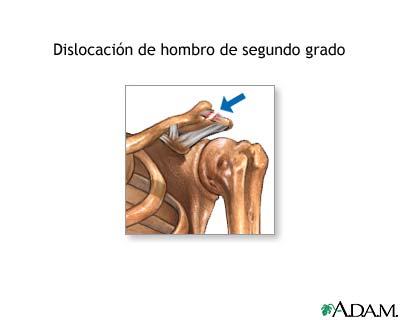 Indicaciones (primera parte)