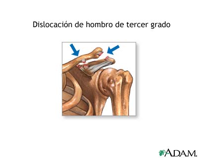 Indicaciones (segunda parte)