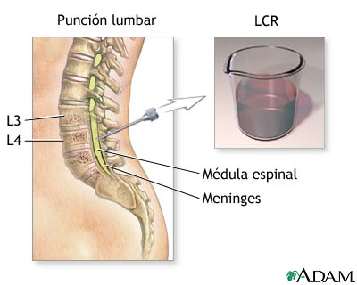 Procedimiento (primera parte)