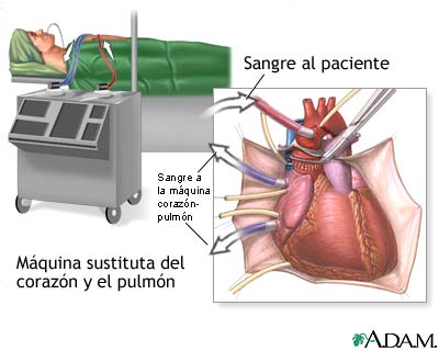 Procedimiento (primera parte)