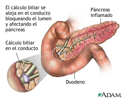 Indicaciones