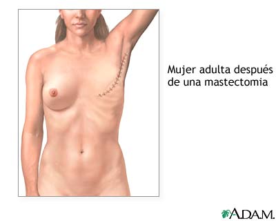 Indicaciones (segunda parte)