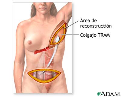 Procedimiento (primera parte)