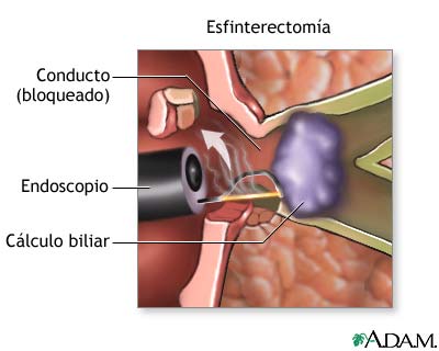 Procedimiento (segunda parte)