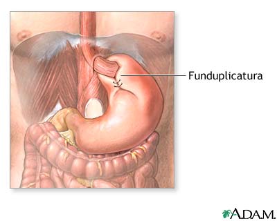 Procedimiento (segunda parte)