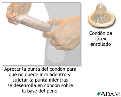 El condón masculino
