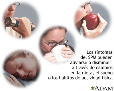 Alivio del SPM
