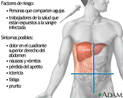 Hepatitis C