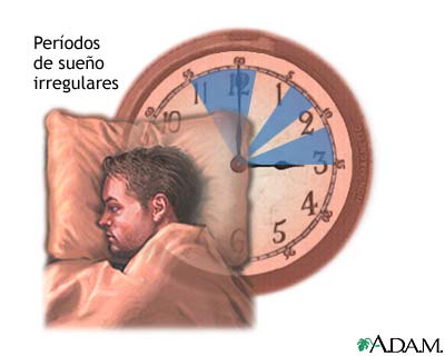 Sueño irregular