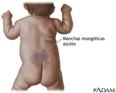 Manchas mongólicas