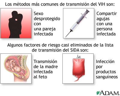 Infección primaria por VIH