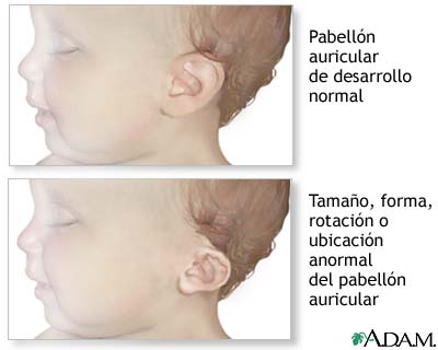 Anomal&iacute;as de la oreja