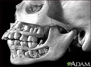 Dientes, adultos, en el cráneo