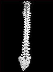 Columna vertebral