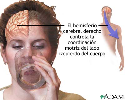 Funci&oacute;n del hemisferio cerebral derecho