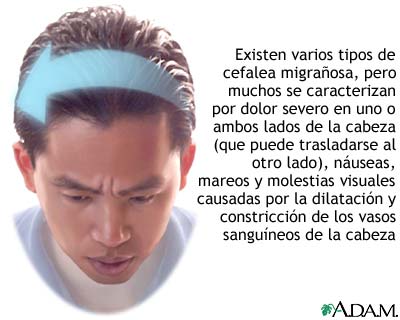 Cefalea migrañosa