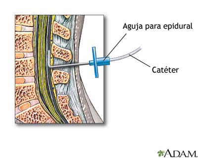 Procedimiento (cuarta parte)
