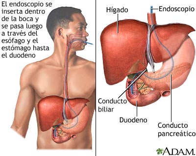 CPER