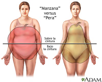 Distintos tipos de aumento de peso